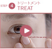 Treat